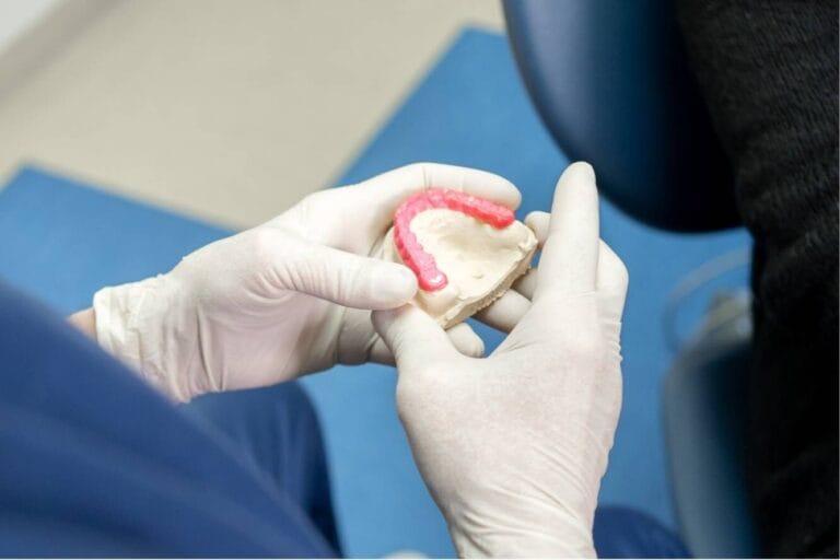 malocclusione dentale - blog